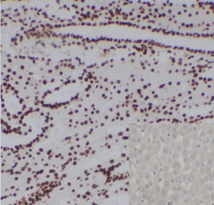 Poly HRP-conjugated Affinipure Goat Anti-Mouse/Rabbit IgG (H+L)