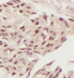 anti- TBP antibody图像