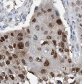  anti- IRF3 antibody