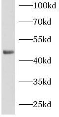  anti- MSI1 antibody