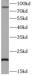  anti- TNFAIP3 antibody