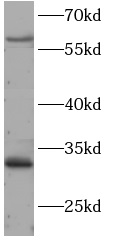  anti- HSF2 antibody