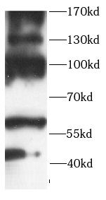      anti- Autotaxin antibody