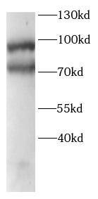      anti-Beta galactosidase antibody