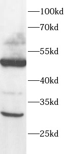      anti-DMC1 antibody