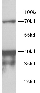      anti-ADA antibody