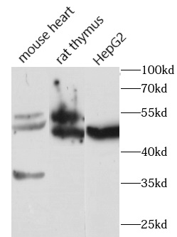 anti-FGFR1 antibody