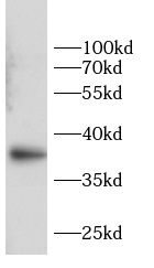      anti-Annexin A2 antibody