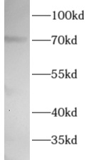      anti-WEE1 antibody