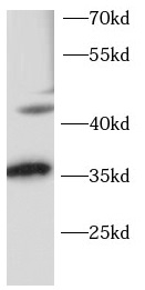      anti-OTX2 antibody