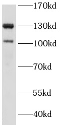 anti-IRS1 antibody