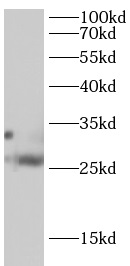      anti-TRADD antibody