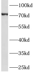 <strong><strong><strong><strong><strong><strong><strong><strong><strong>GHR抗体</strong></strong></strong></strong></strong></strong></strong></strong></strong>