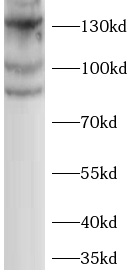  <strong><strong><strong>ELKS抗体</strong></strong></strong>