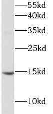      anti-BDNF antibody