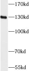      anti-CD31 antibody