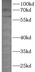      anti-P2RX4 antibody