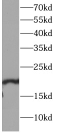      anti-SKP1 antibody