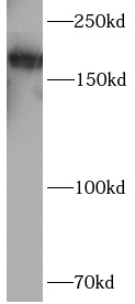      anti-SMARCA4 antibody