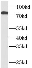 anti-STAT1 antibody