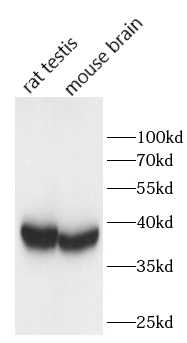      anti-BIRC8 antibody