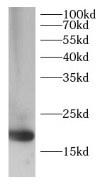 anti-EIF5A antibody