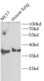      anti-Cyclin D1 antibody