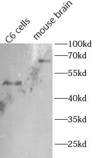      anti-CHAT antibody