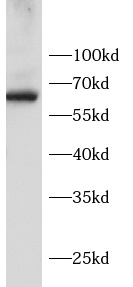 anti- EIF2AK1 antibody