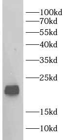 anti-GPX4 antibody