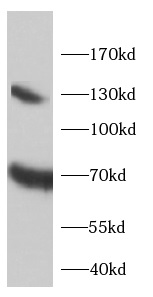      anti-EAAT2 antibody