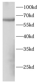      anti-FOXO6 antibody