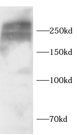 anti-Fibronectin antibody