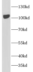 anti-FAK antibody