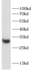      anti-SDC4 antibody