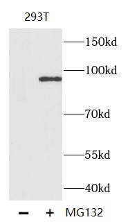 Phospho-β-Catenin (S33/S37/T41)抗体