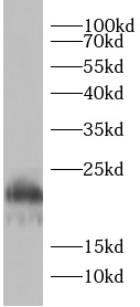 anti-AGR2 antibody