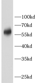      anti-CRAT antibody