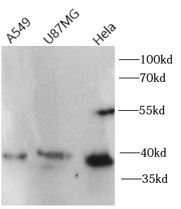      anti-CXCR4 antibody