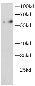      anti-PFKFB3 antibody