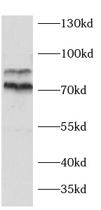      anti-AEG-1 antibody