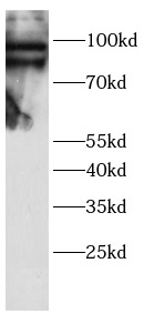 anti-TAB3 antibody