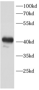      anti-CAB39L antibody