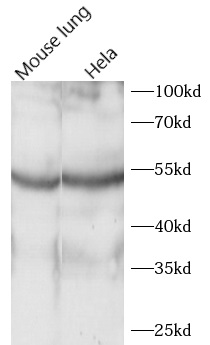      anti-ACOXL antibody