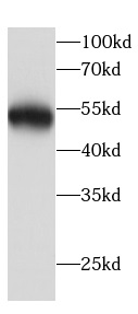      anti-Beclin 1 antibody