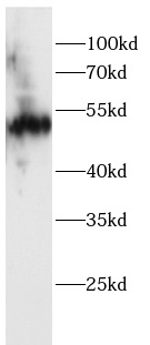      anti-Cytokeratin 7 antibody