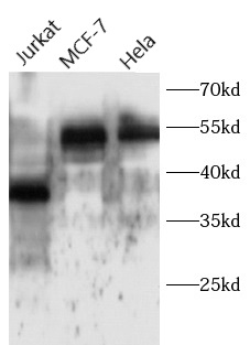 anti-ATF4 antibody