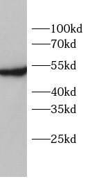      anti- EPOR antibody