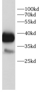 anti- CaMKII delta antibody