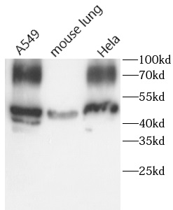      anti-COX2 antibody